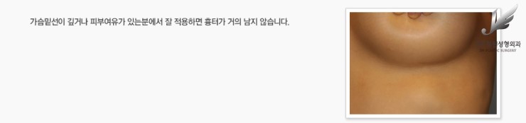 최소박리로 안전하게 황금비율의 가슴을 만드는 HD 내시경 가슴확대 관련 이미지 6