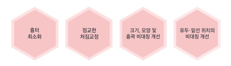 [JW정원성형외과] 처진가슴! 거상없이 확대수술만으로 해결! JW정원 처짐교정확대술 관련 이미지 4