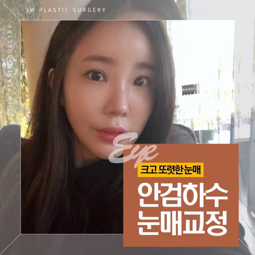 Not Just Simple Double Eyelid Surgery: Improve Eye-Opening Strength with Ptosis Correction image 1