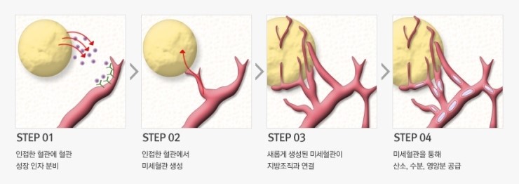 JW정원성형외과 자가지방이식▶ 시간이 지나면 지방이 다 흡수되나요?? 관련 이미지 2