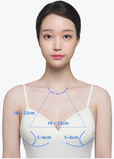 안전하고 정확한 가슴성형 JW정원 HD내시경 가슴확대로 관련 이미지 2