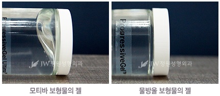 [모티바가슴성형]JW정원성형외과에서 모티바 보형물 체험해보세요! 관련 이미지 1