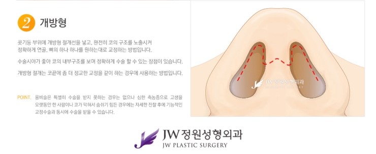 [JW정원성형외과] 낮은코를 개선해주는 낮은코성형 알아봐요! 관련 이미지 4