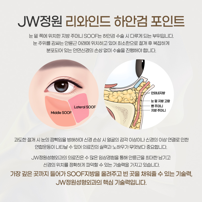 Lower Eyelid Surgery Review: Satisfying Results 【Gangnam JW Garden Plastic Surgery】 image 4