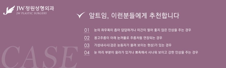 [JW정원성형외과] 시원한 눈매를 완성해주는 트임성형, 트임성형 잘하는 곳에서! 관련 이미지 6