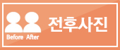 지긋지긋한 비염, 기능 코성형으로 라인까지 예쁘게 관련 이미지 13