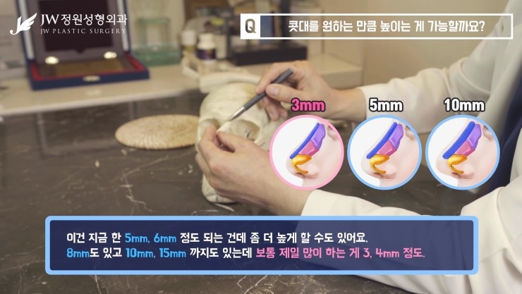 [JW정원성형외과] 코성형 원하는만큼 높이 할 수 있을까? 코성형 Q&A 관련 이미지 7