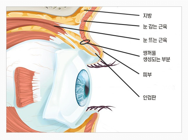 나에게 맞는 쌍꺼풀은? JW정원 쌍꺼풀수술 관련 이미지 2
