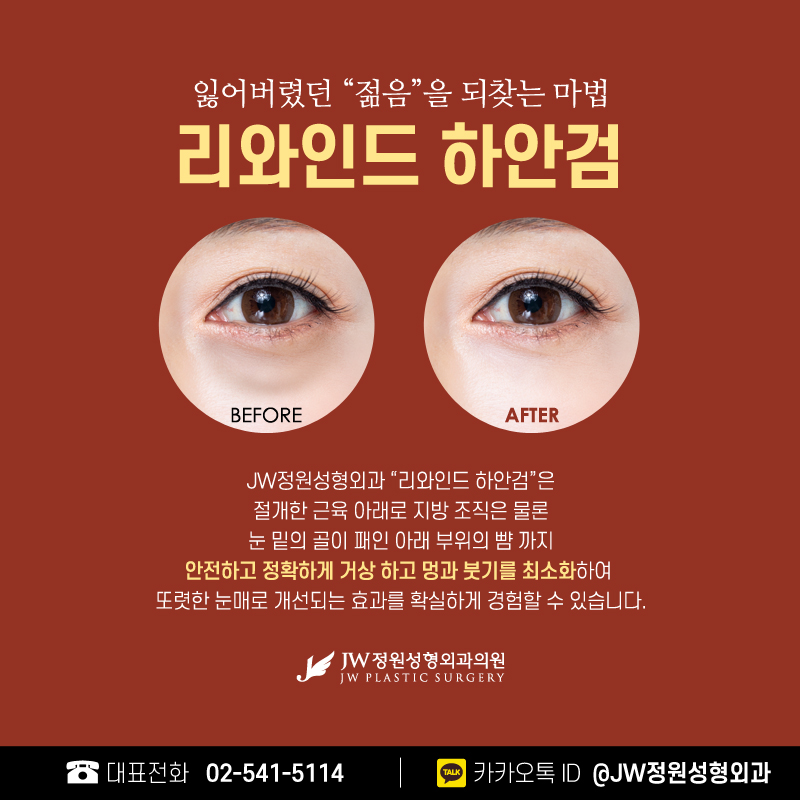 하안검성형외과 나에게 가장 맞는 방법으로 【강남 JW정원성형외과】 관련 이미지 5