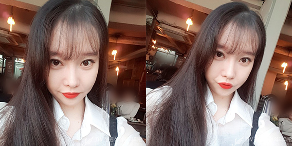 JW정원성형외과 자가지방이식으로 아름다움 완성&hearts; 관련 이미지 5