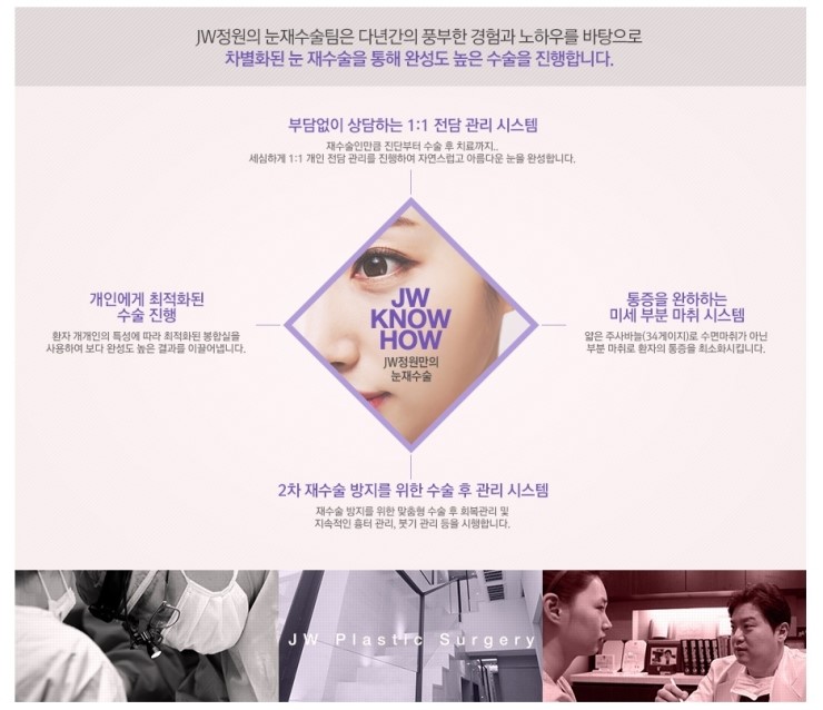 재수술이 아닌 마지막 수술! JW정원성형외과 눈재수술 관련 이미지 8