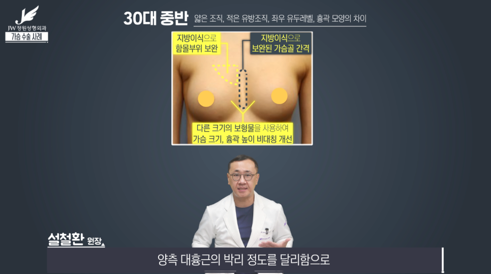 가슴성형수술전후 개인별 맞춤으로 꼼꼼하게! 【강남 JW정원성형외과】 관련 이미지 6