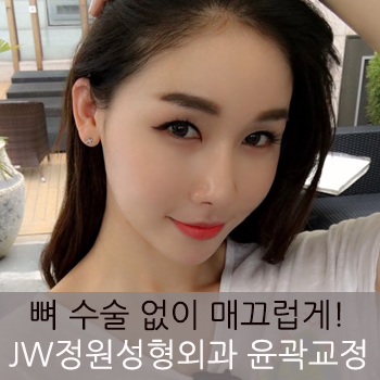 뼈 수술 없이 매끄러운 브이라인얼굴! JW정원성형외과 윤곽교정 관련 이미지 8