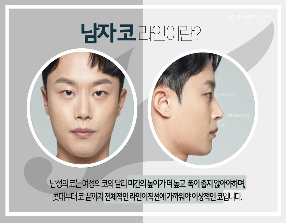 JW Male Rhinoplasty for a Refined Straight Line image 3