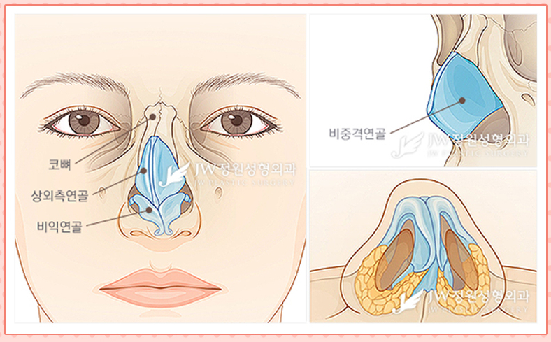 A Deviated Nose, Beautiful Nose Line, and Rhinoplasty with Nasal Obstruction Surgery All at Once! image 2