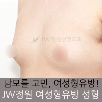 남모를 고민 여성형유방(여유증), JW정원성형외과 여성형유방 수술로 고민해결! 관련 이미지 1