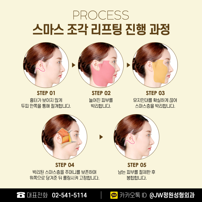 안면거상술잘하는곳 뚜렷한 턱 선을 바란다면 관련 이미지 6