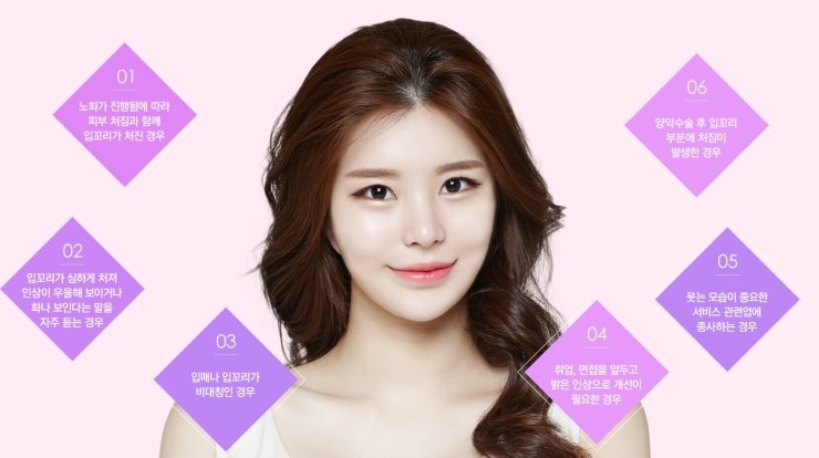 매력적인 입매를 완성하는 JW정원성형외과 입꼬리성형 관련 이미지 6