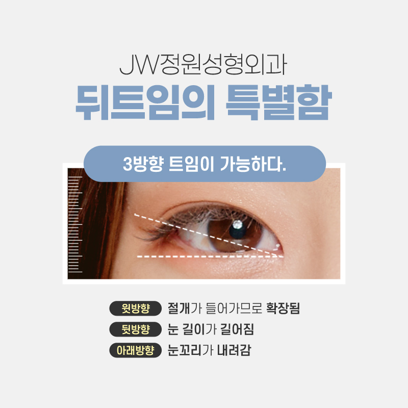 Carefully Check the Cost of Lateral Canthoplasty image 4