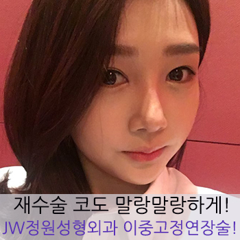 재수술한 코도 말랑하게! JW정원성형외과 핵심기술력 이중고정연장술! 관련 이미지 1