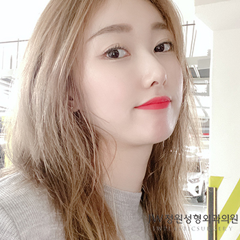 밋밋한 얼굴을 입체감 있는 얼굴로, 낮은코성형후기로 알아봐요 관련 이미지 1