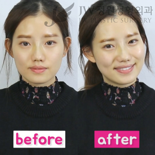 JW코스메틱 마스크팩 사용방법과 후기^^ 30일간의 기적을 체험해보세요! 관련 이미지 15