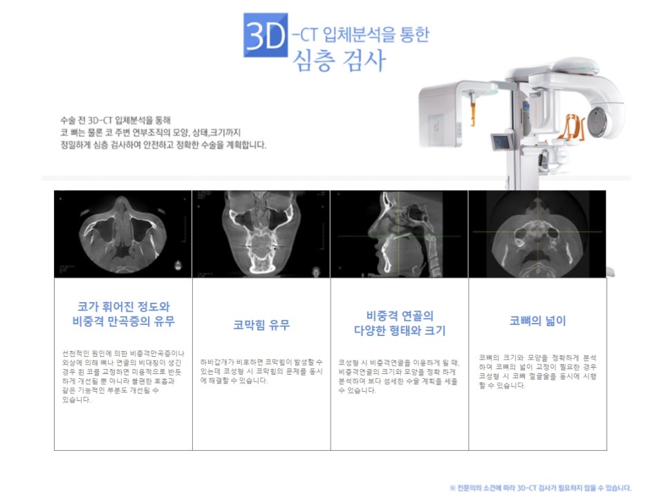 The Standard of Golden Ratio Bulbous Nose Surgery! JW Garden Plastic Surgery image 8