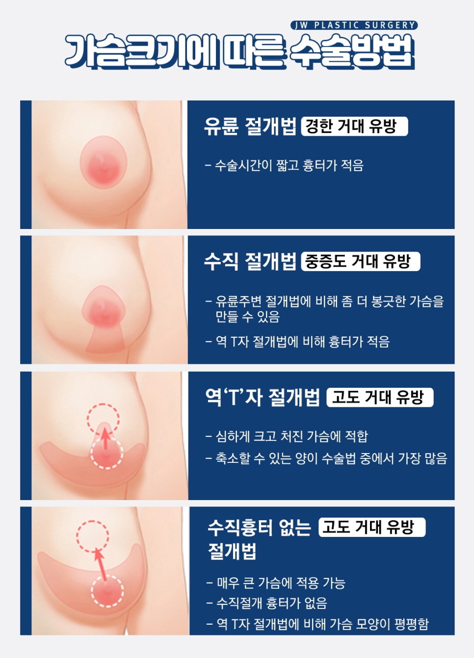 목, 허리, 어깨 통증과 가슴처짐 교정을 위한 가슴축소수술 관련 이미지 3