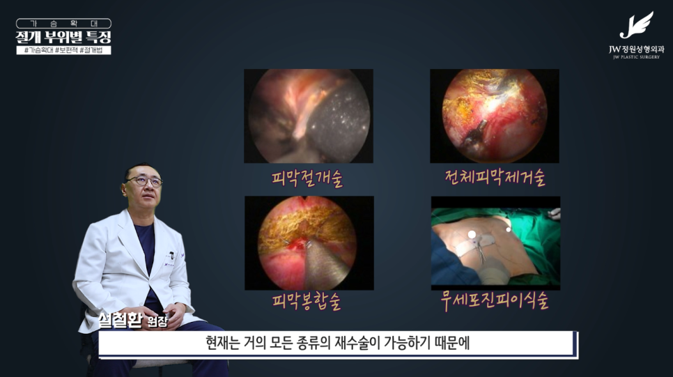 가슴수술흉터 없었던 것처럼 걱정을 덜어주니까! 【강남 JW정원성형외과】 관련 이미지 19