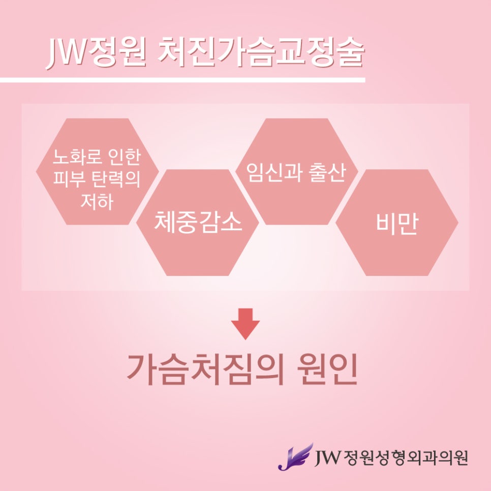 [JW정원성형외과] 처진가슴교정으로 자신감 회복! 관련 이미지 2