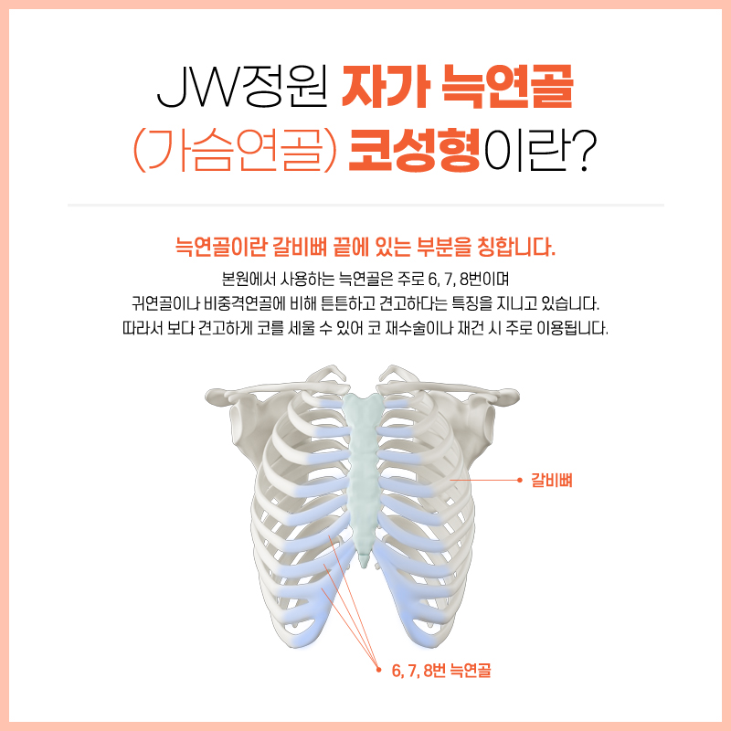 Where to Get Good Nose Surgery: A Sleeker Shape Using Rib Cartilage image 2