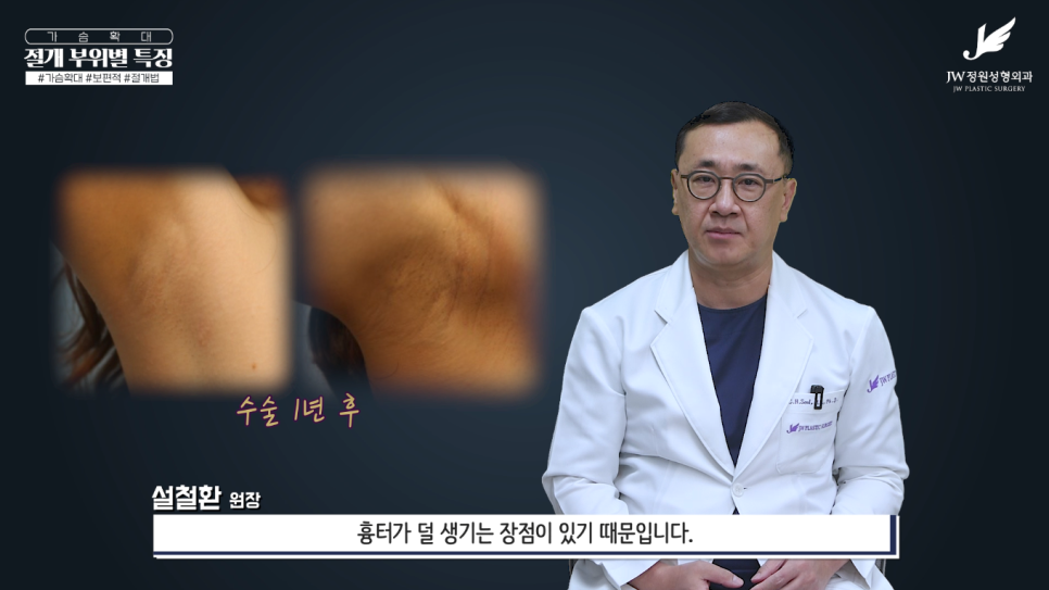 가슴수술흉터 없었던 것처럼 걱정을 덜어주니까! 【강남 JW정원성형외과】 관련 이미지 11