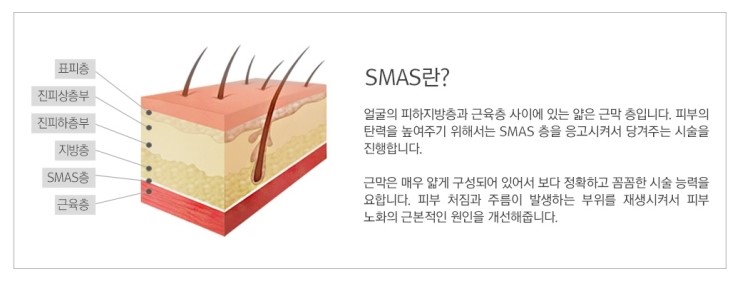 한번의 시술로 탄력 UP! JW정원성형외과 더블로 관련 이미지 3