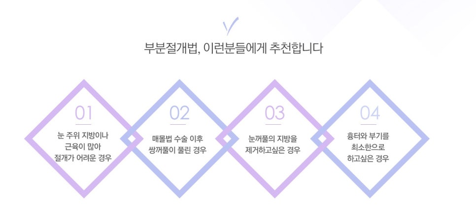 나에게 맞는 쌍꺼풀은? JW정원 쌍꺼풀수술 관련 이미지 8