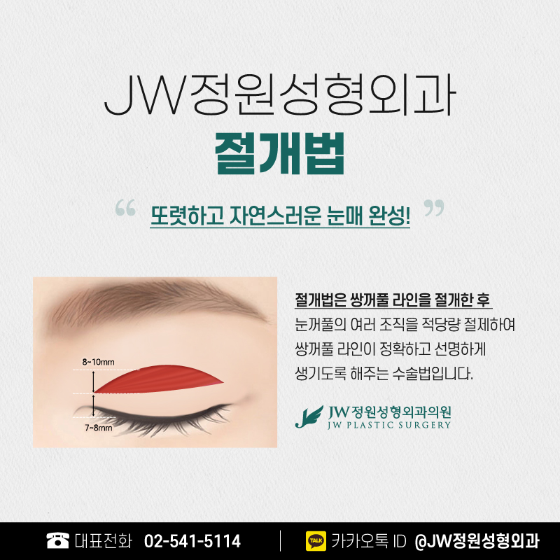 눈성형잘하는병원 크고 예쁜 눈으로 【강남 JW정원성형외과】 관련 이미지 4