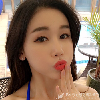 빠르고 간단하게 예뻐지는 노하우! JW정원성형외과 보톡스 관련 이미지 3