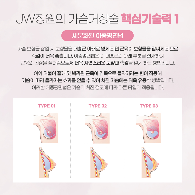 A Breast Lift Procedure Review to Regain Femininity image 3