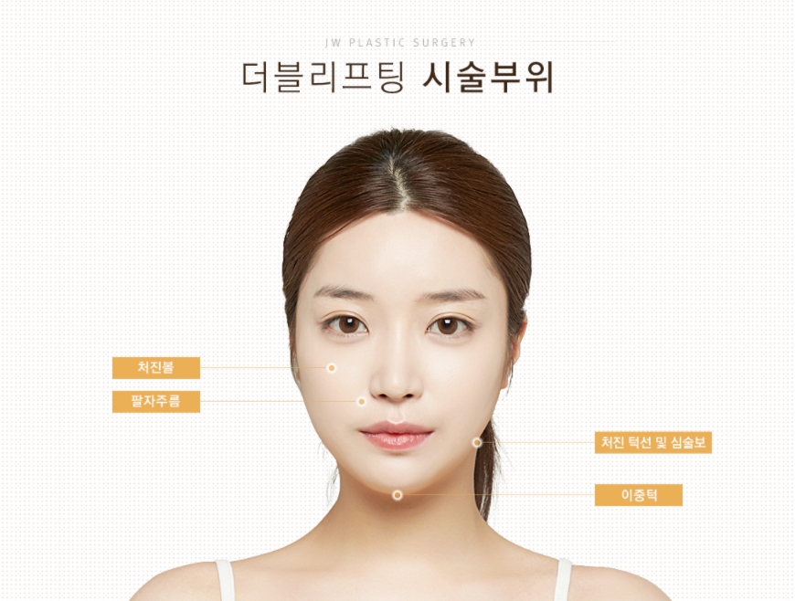 JW정원성형외과 더블리프팅(아큐스컬프&실리프팅)으로 피부 탄력과 브이라인 효과까지 더블로! 관련 이미지 12