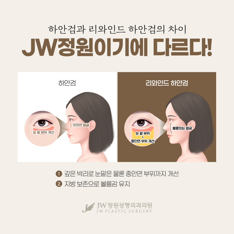 하안검비용 어두운 다크서클이 고민이라면 관련 이미지 2