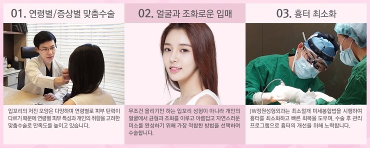 매력적인 입매를 완성하는 JW정원성형외과 입꼬리성형 관련 이미지 5