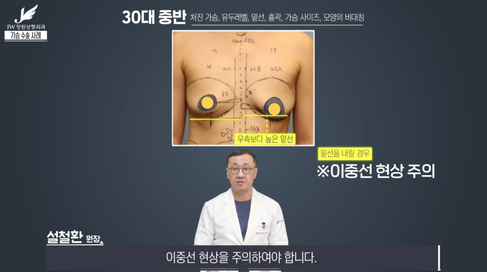처진가슴교정 치밀한 계획으로 완성도는 UP! 【강남 JW정원성형외과】 관련 이미지 8