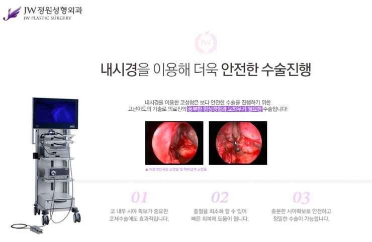 [JW정원성형외과] 매부리코성형, 매부리코성형 잘하는 곳에서 고민해결! 관련 이미지 11