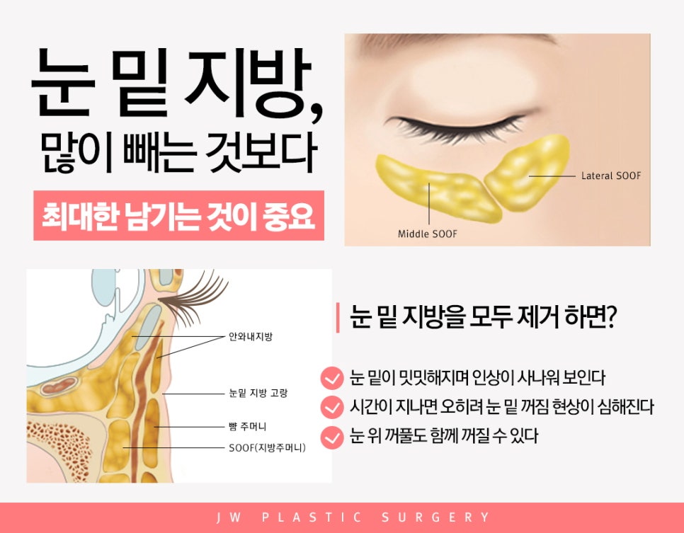 The Secret to a Youthful Eye Shape in Middle Age! Rewind Lower Blepharoplasty image 4