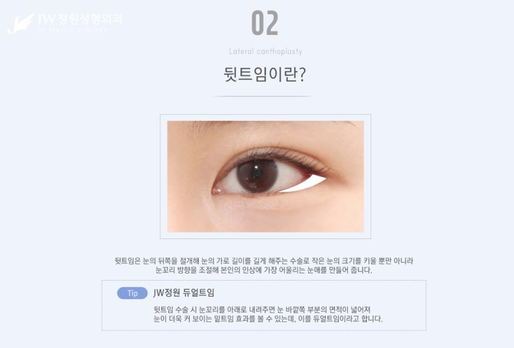 [JW정원성형외과] 시원한 눈매를 완성해주는 트임성형, 트임성형 잘하는 곳에서! 관련 이미지 7
