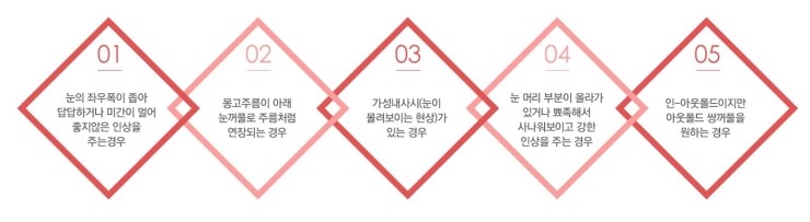 시원하고 자연스러운 눈매! JW정원성형외과 트임수술 관련 이미지 3