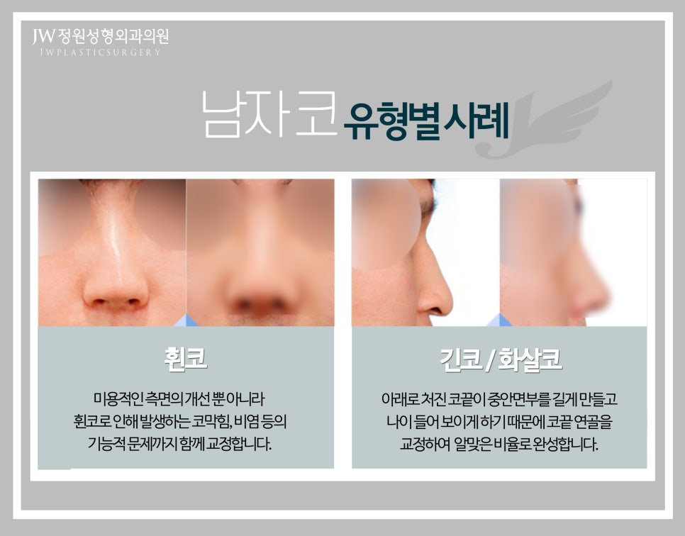JW Male Rhinoplasty for a Refined Straight Line image 5