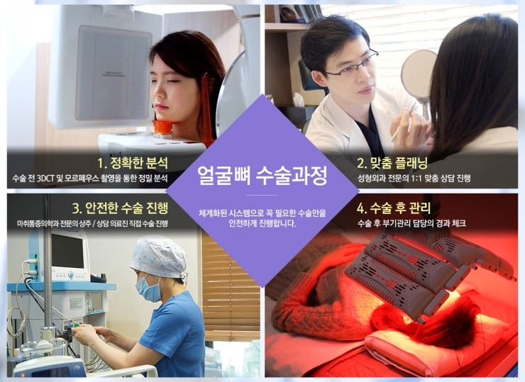 내 얼굴의 황금비율 찾아주는 JW정원성형외과 긴 얼굴 수술 관련 이미지 4