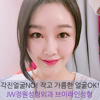 각진 얼굴 NO! JW정원성형외과 브이라인 성형으로 작고 갸름한 얼굴 완성 관련 이미지 1