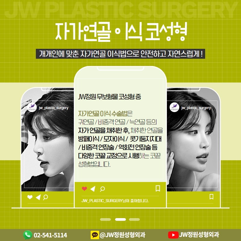빙글빙글 돌아가는 무보형물 코수술 [코끝성형] 관련 이미지 5
