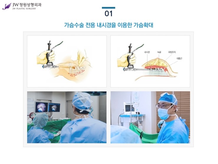 [JW정원성형외과] 가슴보형물 + 가슴지방이식 장점을 담은 콤비네이션 가슴확대성형 관련 이미지 6